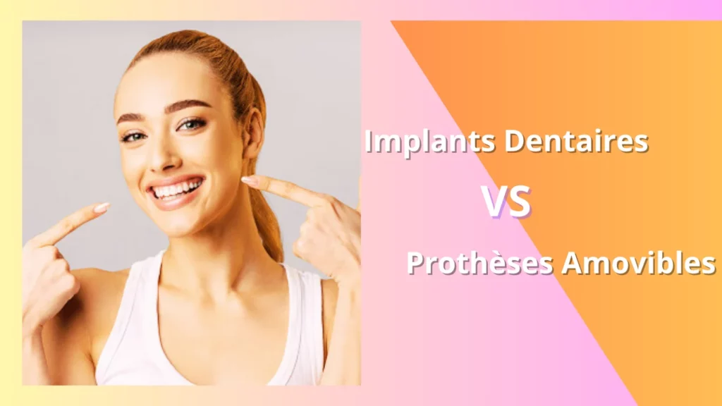 Implants Dentaires vs Prothèses Amovibles - Cabinet Azur Dentaire à Nice